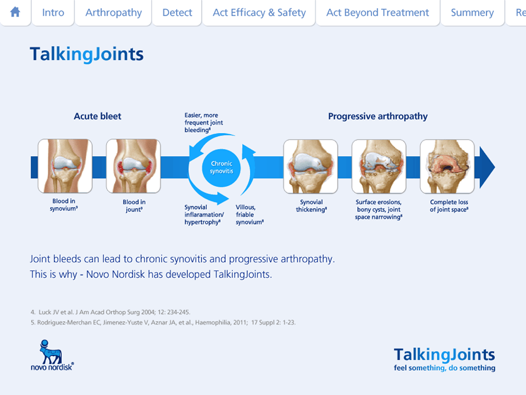 TalkingJoints